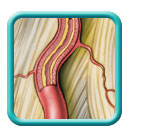 Thumb-diabetic-multiple-mononeuropathy-image